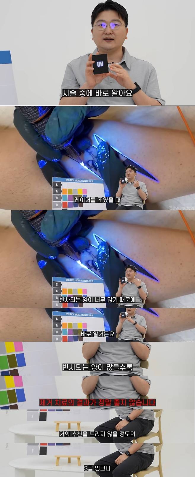 피부과 의사가 문신 제거를 말리는 색상.jpg