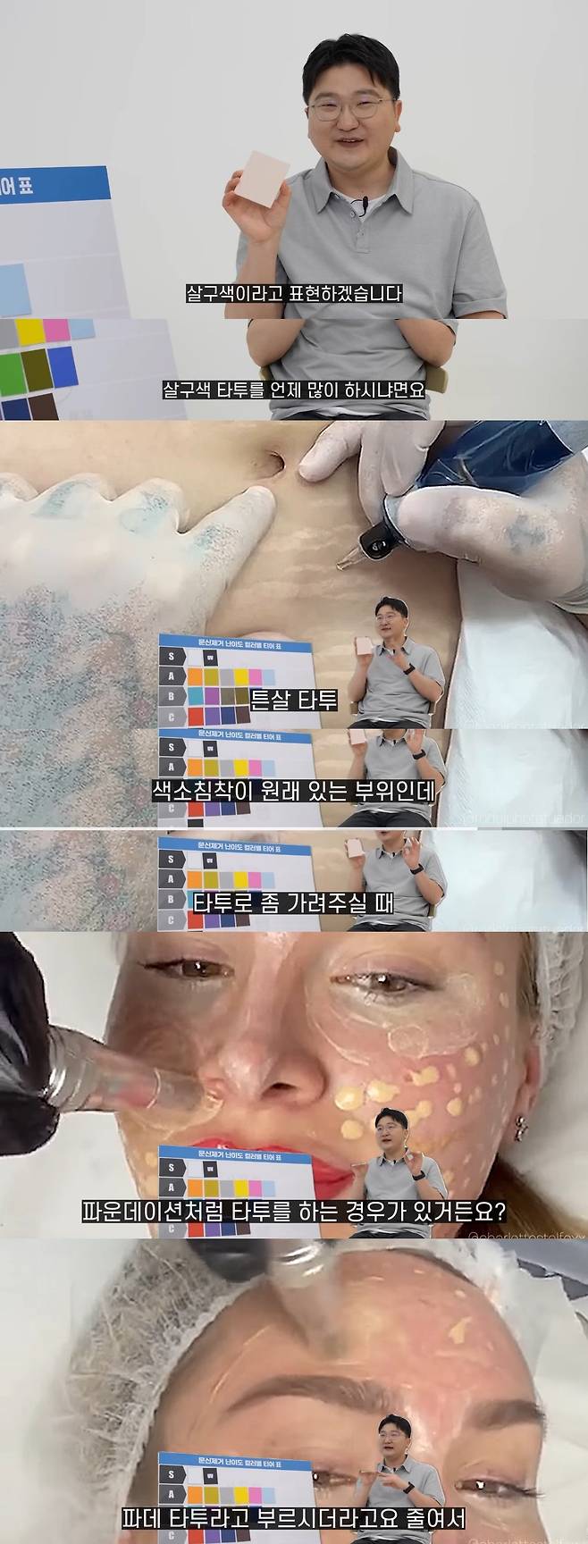 피부과 의사가 문신 제거를 말리는 색상.jpg