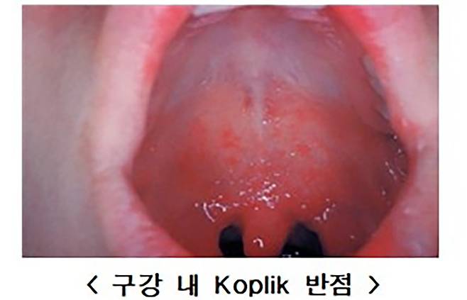 질병관리청 제공