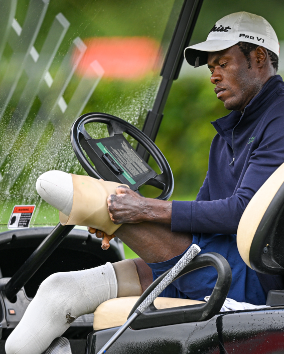 은라렙이 의족을 신을 준비를 하고 있다. 게티이미지