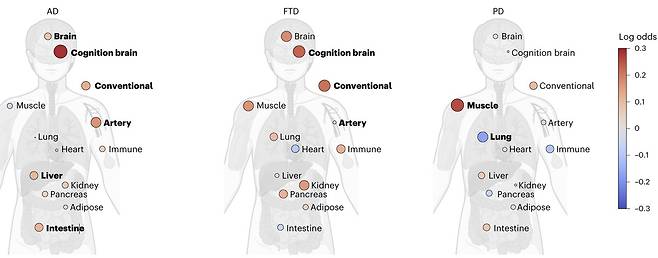 표준화된 장기 연령 격차와 신경퇴행성 질환 간 연관성 그래픽 표준화된 장기 연령 격차(standardized organ age gap)와 알츠하이머병(AD) 및 전측두엽 치매(FTD), 파킨슨병(PD)과의 연관성 그래픽. 그림에서 빨간색은 장기의 노화 정도가 질병과 양의 연관성이 있음을, 파란색은 음의 연관성이 있음을 나타내며, 원의 크기와 굵은 글씨는 연관성 또는 중요도가 크다는 것을 의미한다. [Nature Medicine / Farhad Imam et al. 제공. 재판매 및 DB 금지]