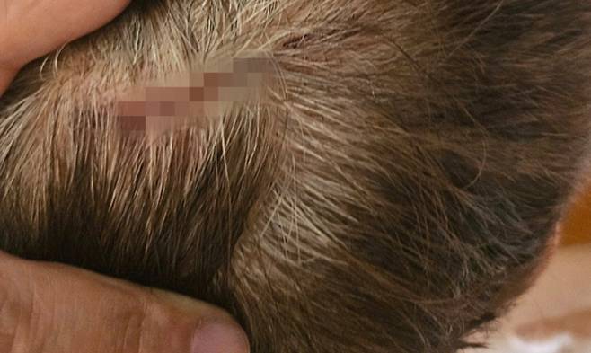 지난 5일 울산 중구의 한 정류장에서 버스에 탑승하던 승객이 문에 끼인 채 버스가 출발하며 타박상 등 피해를 입었다. 독자 제공