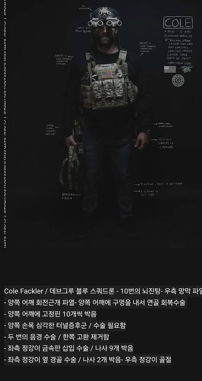 img/23/09/29/18ae0ad087a559594.jpg 17년 근무한 미 특수부대 대원 신체 상태.jpg 17년 근무한 미 특수부대 대원 신체 상태.jpg