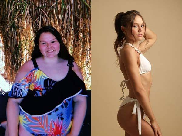 제시카 터너(20)는 중고등학교 시절 폭식과 운동 부족으로 체중이 105kg까지 증가했​는데 다이어트로 52kg을 감량했다./사진=데일리메일