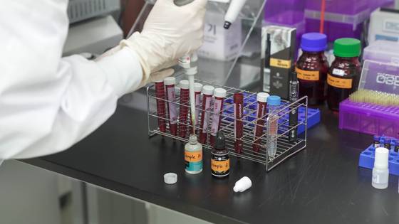 담배 유해성분을 모아둔 실험용기. 사진 질병관리청