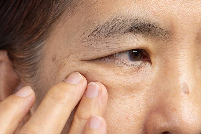 우리나라 60대 이상 성인 10명 중 7명은 백내장을 앓고 있다. 방치하면 실명에 이를 수 있어 조기치료가 중요하다. 게티이미지뱅크