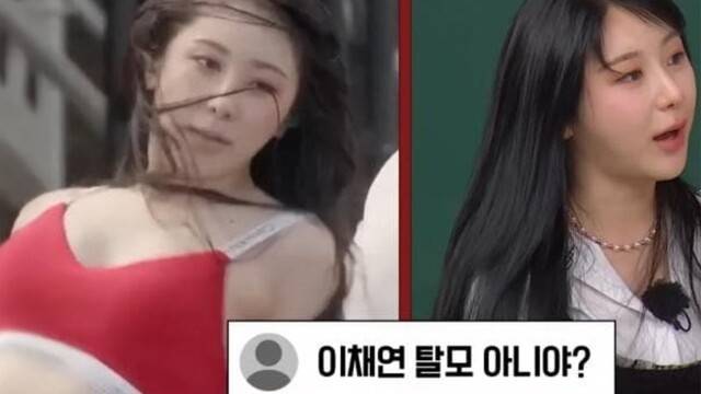 이채연은 과거 워터밤 공연에서 흑채가 물에 씻겨 내려가 탈모 논란을 겪은 후, 3571모의 머리카락을 이식받았다고 밝혔다｜출처: JTBC '아는 형님' 캡처
