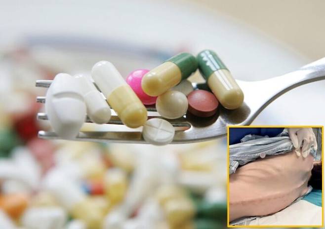 중국 상하이에 거주하는 39세 여성이 하루 200알에 달하는 다이어트 약을 12년간 복용한 끝에 체중이 25kg까지 줄고 심각한 건강 문제를 겪게 됐다. [배경사진=게티이미지뱅크/오른쪽 하단 사진=SNS]