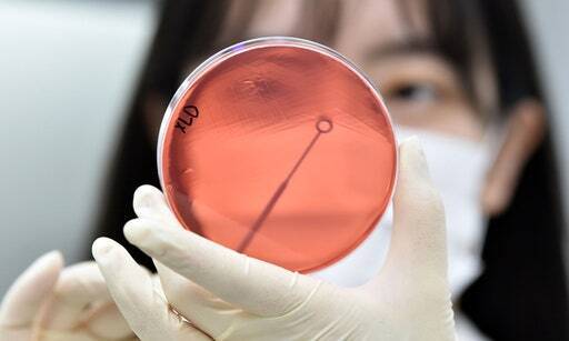 식중독균 배양분리작업 하는 모습. 뉴시스