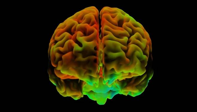 긍정적인 사람들은 뇌 내측 전전두엽 피질 활동이 비슷하다는 연구 결과가 나왔다. /Science Photo Library
