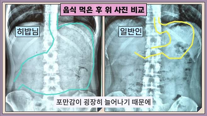 Screenshot_20250723_212939_YouTube.jpg 아무리 먹어도 살 안 찌는 먹방 BJ들의 비밀.JPG