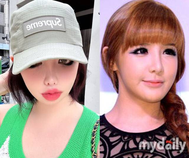박봄이 올린 사진에서 턱 보정 여부에 관심이 집중되고 있다. / (왼쪽) 박봄 소셜미디어, (오른쪽) 마이데일리 DB
