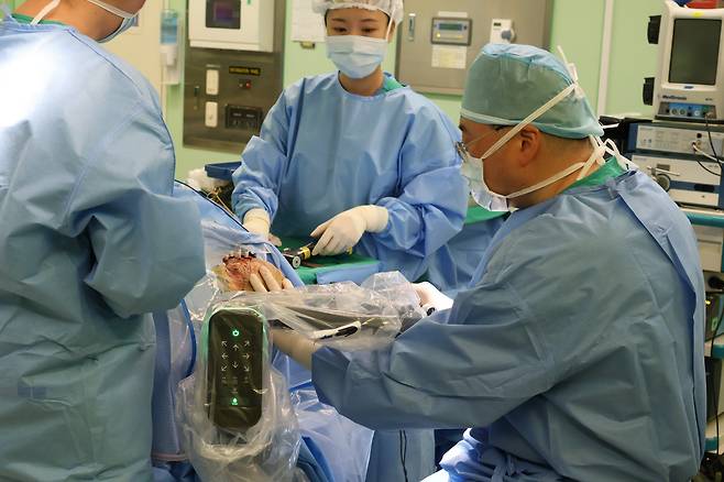 장원석 교수가 뇌수술 로봇장비 지니언트 크래니얼을 이용해 환자의 뇌심부에 전극을 삽입하고 있다. 로봇 시스템을 이용한 뇌전증 수술은 약 2~3mm의 작은 구멍으로 전극을 삽입할 수 있어 부작용이나 수술 후 통증도 줄일 수 있다고 장 교수는 설명했다. /고영테크놀러지