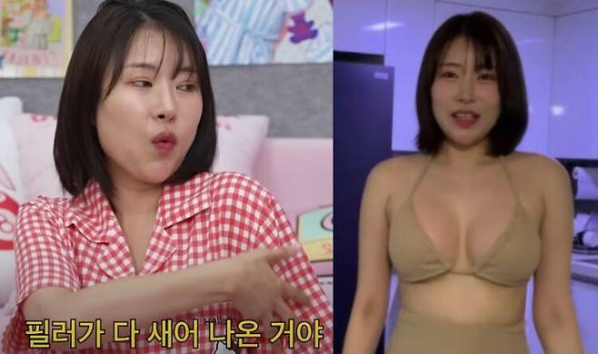 이세영이 가슴 필러 부작용을 겪고 결국 가슴 수술을 받았다고 말했다. [사진=유튜브 채널 '이게진짜최종'/'영평TV' 영상 캡처]