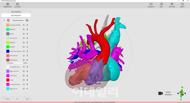 3D 해부 구조 시각화 소프트웨어 ‘Arc Viewer’(사진 = Rady 어린이병원)