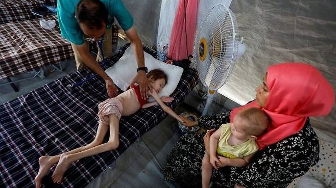 [서울=뉴시스]가자지구에서 굶주려 뼈만 앙상한 어린이 모습. (NGO 제공, 알자지라에서 재인용) 2025.7.28. *재판매 및 DB 금지