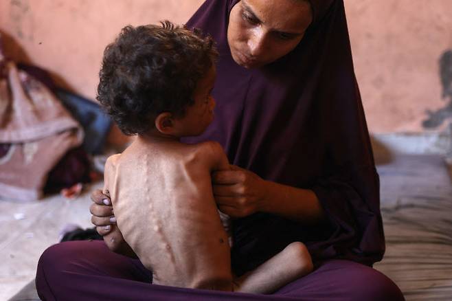 나에마(30세)는 가자시티 서쪽 알-샤티 난민 캠프의 파손된 집에서 영양실조 상태인 2세 아들 야잔과 함께 앉아 있다. 이 장면은 2025년 7월 23일에 촬영됐다. 수십 개의 구호 단체와 인권 단체들은 수요일, “대규모 굶주림”이 가자에서 확산되고 있다고 경고했다. 이는 미국이 최고 특사가 유럽으로 향해 휴전과 구호 통로에 대한 협상을 진행할 것이라고 밝힌 시점과 맞물렸다. (사진=AFP)