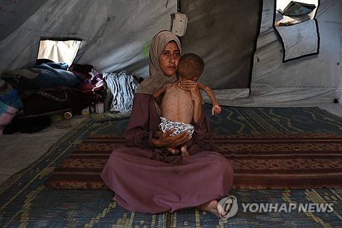 뼈가 앙상한 아기 안고 있는 가자지구의 한 주민 [AFP=연합뉴스 자료사진. 재판매 및 DB 금지]