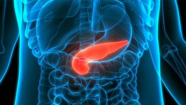 췌장암은 초기 증상이 거의 없어 진단이 늦고, 예후가 매우 나쁜 암으로 알려져 있다|출처: 클립아트코리아