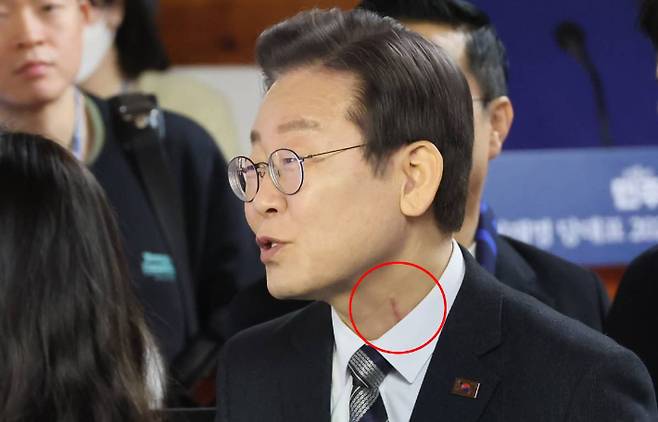 선명한 피습 상처. 연합뉴스