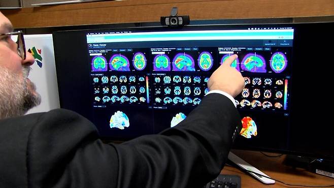 미국 메이요클리닉의 데이비드 존스 신경과 AI 프로그램 담당 교수가 새로운 AI 진단 도구인 '스테이트뷰어(StateViewer)'를 소개하고 있다./메이요클리닉