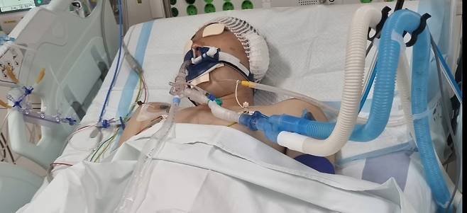 안태랑씨가 포신에 얼굴이 끼이는 사고를 당한 후 병원에 입원하고 있다. 사진=TAERANI 유튜브 계정 갈무리