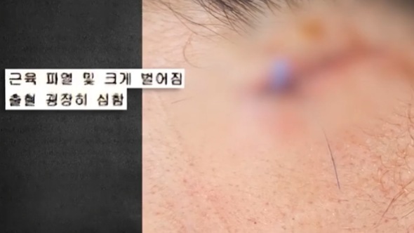 ⓒMBC