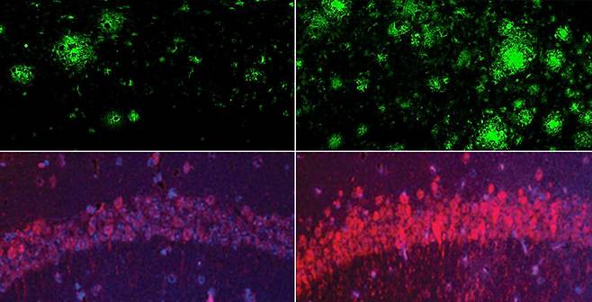 (위) 생쥐 실험에서 리튬이 결핍된 생쥐의 뇌(오른쪽)는 리튬 수치가 정상인 생쥐 뇌(왼쪽)에 비해 아밀로이드 베타 단백질 플라크가 훨씬 많다. (아래) 알츠하이머병 신경섬유다발 단백질인 타우에서도 동일한 현상이 나타났다. Yankner Lab 제공