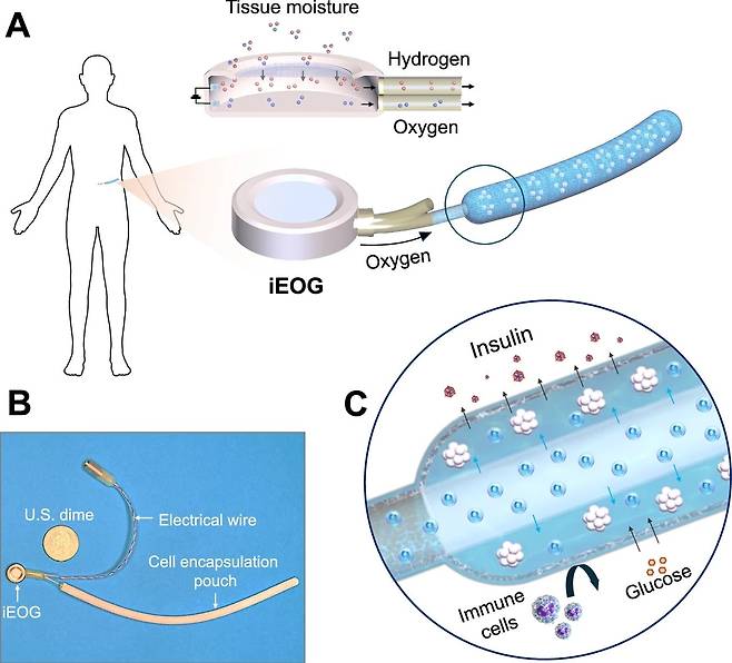 췌도 이식 시스템은 산소 발생기(iEOG)와 실 모양의 췌도 캡슐로 구성된다. A. 산소 발생기에서 인체에 있는 수분을 전기분해해 산소를 만든다. B. 췌도 캡슐은 길이 15㎝, 지름 5㎜이다. C. 캡슐의 단면도. 면역세포 공격은 막고 당분을 흡수하고 인슐린을 밖으로 보낸다./Nature Communications
