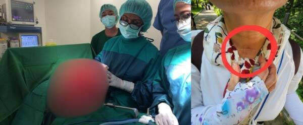 오진으로 불필요한 수술을 받거나, 증상이 나타났을 때 적절한 조치를 받지 못해 의식불명 상태에 이른 환자 사례. 왼쪽은 말레이시아 환우회 소속 환자의 사례로, 내장 부종을 겪었으나 충수염으로 오진 받아 불필요한 개복 수술을 진행했다. 오른쪽은 국내 여성 환자로, 후두부종을 빨리 조치하지 못해 의식 불명 상태에 이르렀고, 기관지 절개술을 받은 끝에 겨우 회복했다. 박 씨는 현재 트라우마로 인해 공황장애 증상을 함께 겪고 있다. /사진=민수진 씨 제공