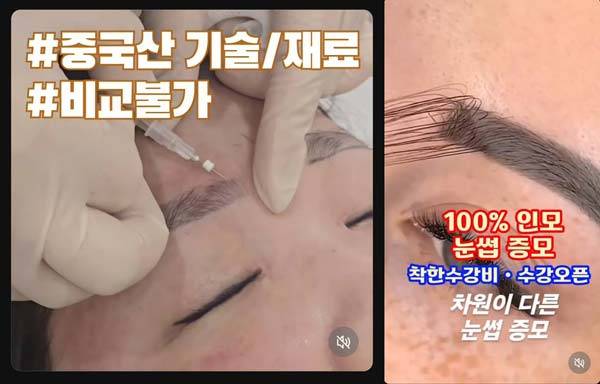 (왼) 한 에스테틱 샵에서 올린 불법 눈썹 증모술 시술 영상 일부 (오) 또 다른 에스테틱 샵에서 올린 시술 영상 일부/사진=소셜미디어 갈무리