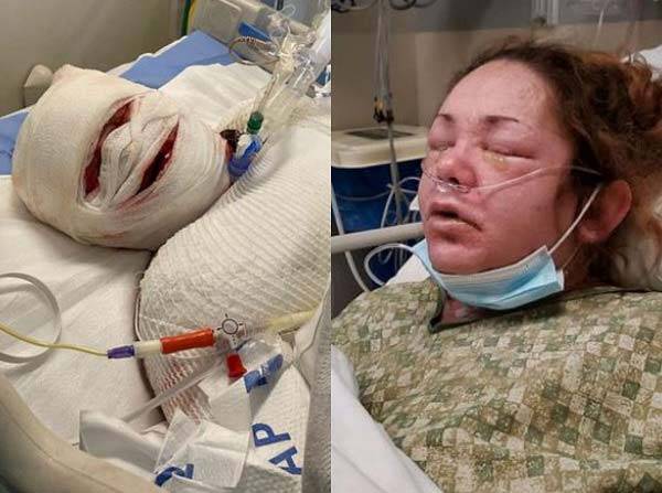 미국의 한 20대 여성이 진통제를 복용한 후 끔찍한 부작용을 겪은 사연이 공개돼 화제다./사진=데일리메일