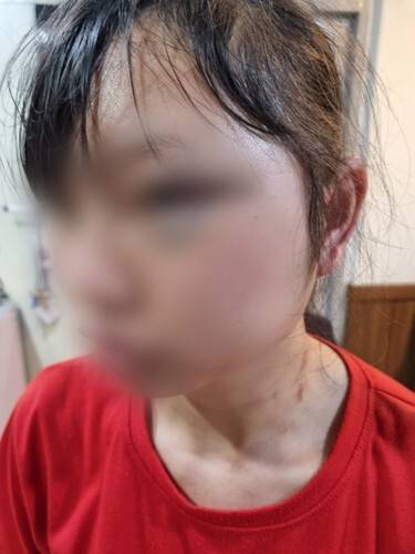 상해 피해를 입은 B 씨 / 사진=B 씨 측 제공, 연합뉴스