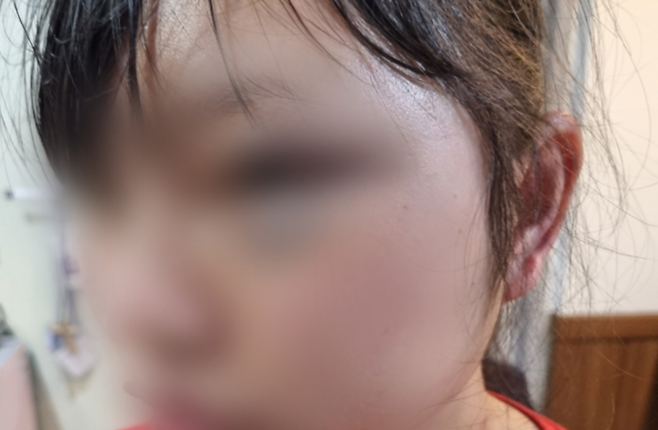 함께 일하던 20대 베트남 국적 여직원의 얼굴을 발로 걷어차는 등 폭행한 40대 남성 A씨에게 검찰이 징역 2년을 구형했다. [사진출처 = 연합뉴스]