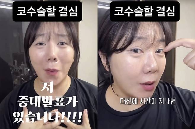 허안나. 사진| 허안나 SNS