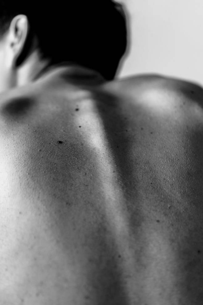 편평사마귀는 인유두종바이러스 감염으로 발생한다. 유전과 무관하며 피부 접촉은 물론이고 일상 용품을 공유했을 때에도 옮을 수 있다. 돌기 형태로 나타나는 쥐젖은 감염으로 생기는 것은 아니나 피부 마찰이 잦은 곳에 제한 없이 늘어날 수 있어 미용상의 불편함을 유발하기도 한다. 두 질환 모두 초기에 치료하면 흉터 없이, 일회 치료로 제거할 수 있다. 사진: Unsplash