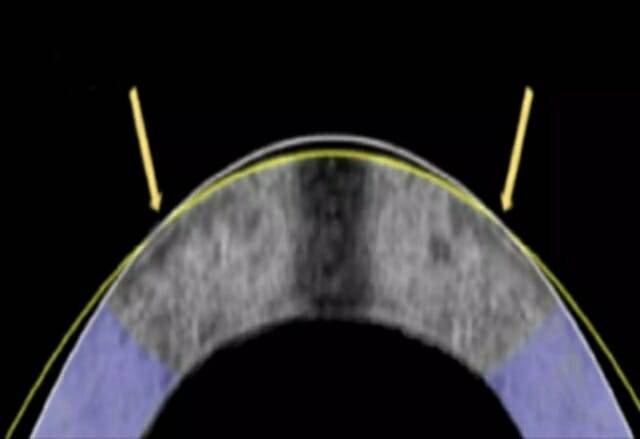 전기기계적 재형성(EMR) 기법을 설명한 그림 (사진= 마이클 힐 미국 옥시덴탈 칼리지 교수 외 / ACS 생체재료 과학 및 공학)