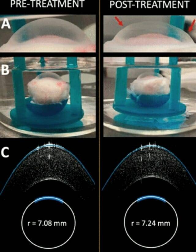 EMR 치료 전후 토끼 각막, 각막 곡률이 바뀌었다. (사진= 마이클 힐 미국 옥시덴탈 칼리지 교수 외 / ACS 생체재료 과학 및 공학)