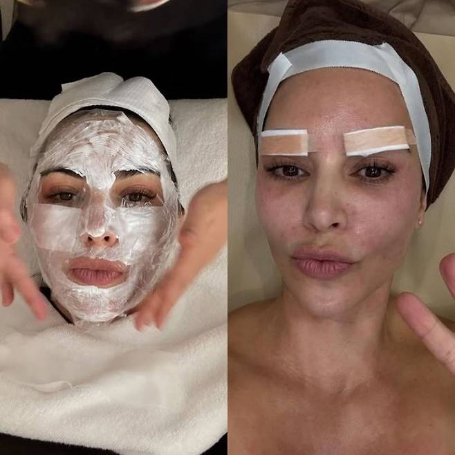 한국 방문 중 피부과 시술을 받는 킴 카다시안. SNS 갈무리 @kimkardashian