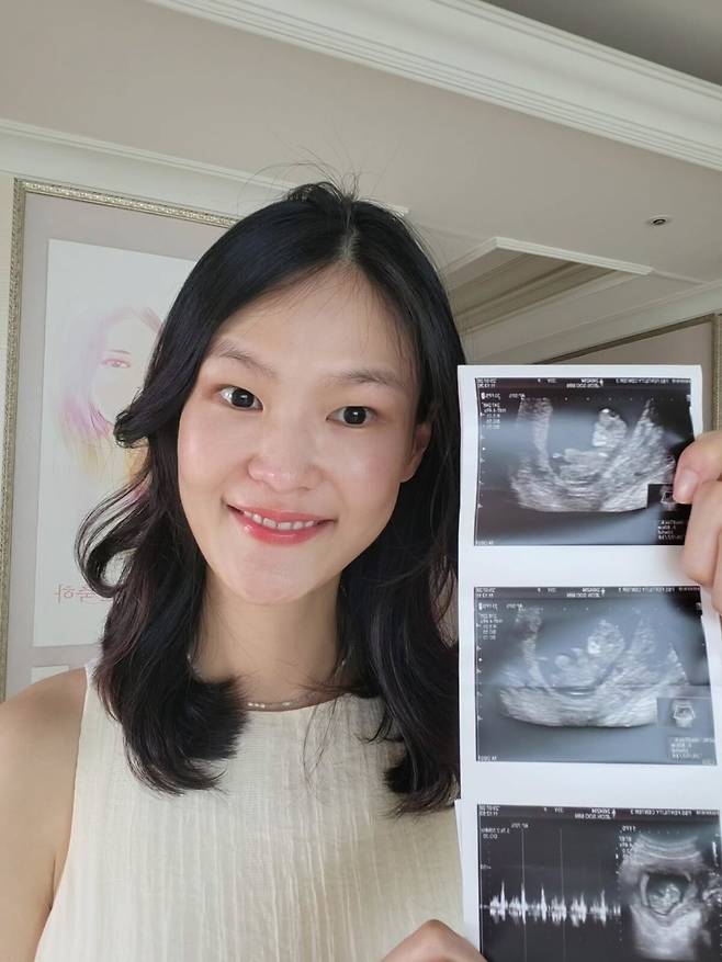 전수민이 초음파 사진을 들고 행복한 미소를 짓고 있다. 김경진 SNS 캡처