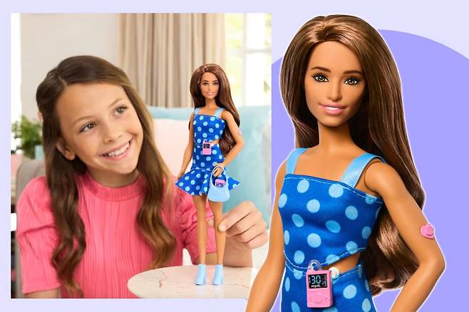 1형 당뇨병 환자를 모델로 한 바비 인형. 팔에 혈당 측정 패치를 붙였고 허리에는 인슐린 주입 펌프가 있다./마텔