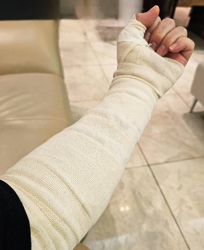 보이그룹 원타임 출신 성우 송백경이 팔뚝 문신 제거 시술 직후 올린 사진. /인스타그램