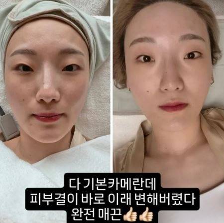 히밥 소셜미디어