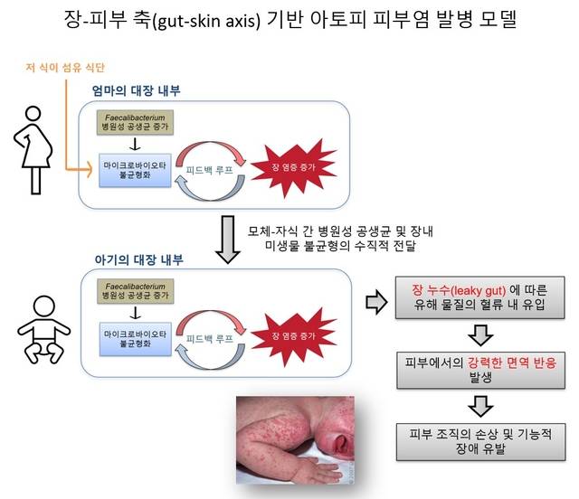 병원성 공생균 기반 아토피 피부염 발병 모델. 김희남 교수 제공