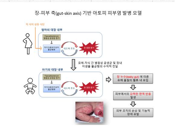 국내 연구팀이 아토피 피부염의 원인을 동물 실험을 통해 알아냈다. [사진=한국연구재단]