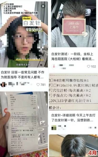 중국에서 흰 머리를 검게 만든다는 ‘백발주사(白发针)’가 중국 대도시를 중심으로 유행하고 있다. 상관신문