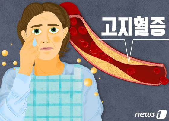 불규칙한 생활 습관이나 운동 부족도 이상지질혈증을 유발할 수 있다. 스테로이드 제제 같은 약물이나 임신과 같은 신체 상태도 콜레스테롤 수치를 일시적으로 올릴 수 있다. 다양한 혈관 질환의 발생률과도 연관돼 관심을 기울여야 한다. ⓒ News1 DB