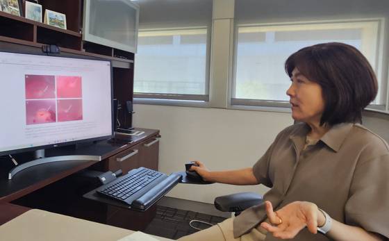 지난달 11일 미국 오하이주 콜럼버스시 오하이오주립대에서 만난 이지영 보건학 교수가 마이크로시스틴과 간암의 연관성 연구에 대해 설명하고 있다. 콜럼버스=정은혜 기자