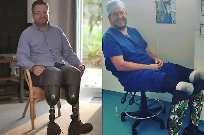 영국에서 신체 절단에 대한 성적 관심으로 일부러 다리를 절단한 뒤 보험금을 받아 챙긴 의사가 실형을 선고받았다./사진=BBC, 인스타그램