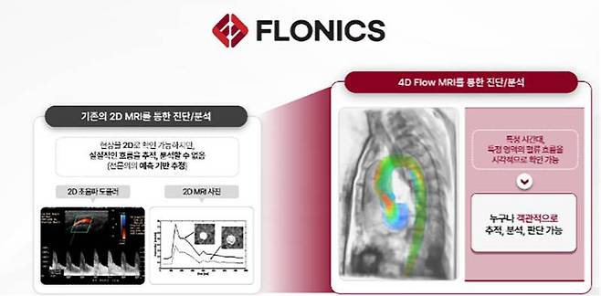 플로우닉스 4차원 혈류 분석 기술 / 출처=카카오벤처스